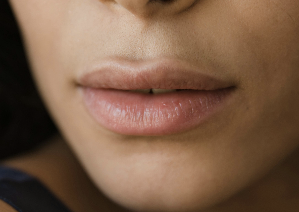 De lip plumper die hetzelfde effect geeft als 1ml filler